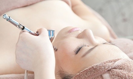 One Crystal Microdermabrasion Treatmens at Smooth Laser Clinic Salon and Spa (62% Off)