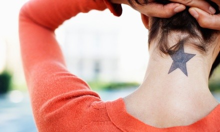 Tattoo-Removal Sessions on an Area up to Two, Four, Six, or Nine Square Inches at Beauty Works (Up to 71% Off)