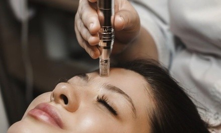 One or Three PRP Facials with Microneedling Sessions at Darling Med Spa (Up to 60% Off)