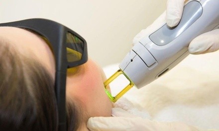 Up to 84% Off on SHR Laser Hair Removal at Depilex Aesthetics