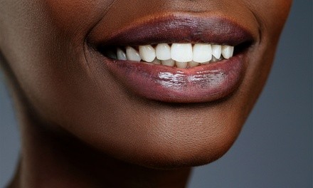 Up to 50% Off on Teeth Whitening - In-Office - Non-Branded at VVS CELEBRITY SMILEZ