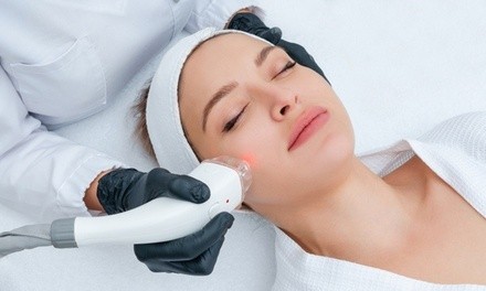 Up to 60% Off on Laser Skin Resurfacing-Unbranded at Back To Health