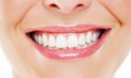 Up to 60% Off on Teeth Whitening - In-Office - Non-Branded at Totally Cool Makeup