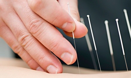 One or Three Acupuncture Treatments with Initial Assessment at Rejuvenate Center (Up to  Off)