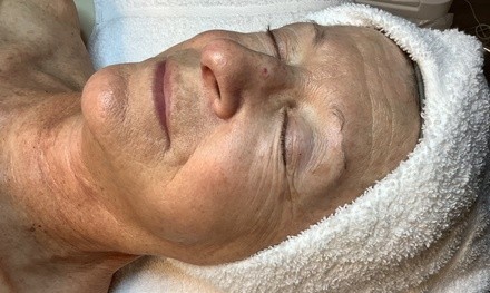 Up to 50% Off on Facial - Thermal Rejuvenation at Clear Esthetics