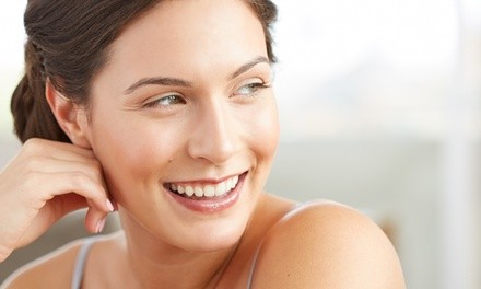 One or Three Photofacials at Cristina Nicastro's Laser Clinic (Up to 81% Off) 