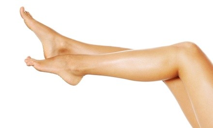 Two or Four Laser Spider-Vein-Removal Treatments at Amoré Laser (Up to 72% Off)