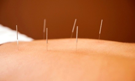 One or Two Acupuncture Treatments at Jing River Acupuncture (Up to 43% Off)