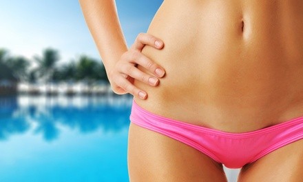 Up to 71% Off on Laser Hair Removal at Flawless Reflections Body And Skin Therapy