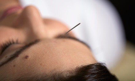 One or Three Facial Acupuncture Rejuvenation Sessions at Rejuvenate Center (Up to 54% Off)