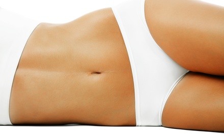 Two or Four Sessions of Noninvasive Lipo-Light at Bay Area Disc Centers (Up to 66% Off) 