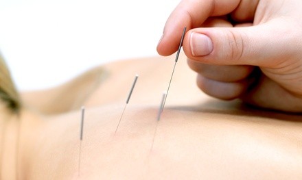 One, Two, or Three 60-Minute Acupuncture Sessions at Chen's Acupuncture and Wellness Center (Up to 87% Off)