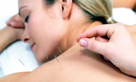 One or Three Acupuncture Packages at Bethesda Chiropractic & Acupuncture Clinic (Up to 82% Off)