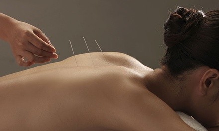 One or Three Acupuncture Sessions with Relief Therapy at ABC Bodyworks (Up to 80% Off)