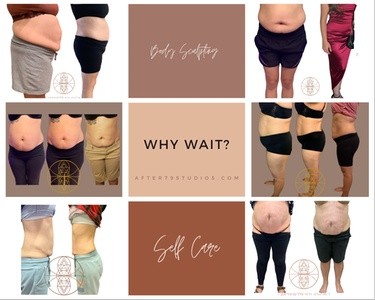 Up to 50% Off on Lipo - Non-Invasive Laser-iLipo at After79 Studios