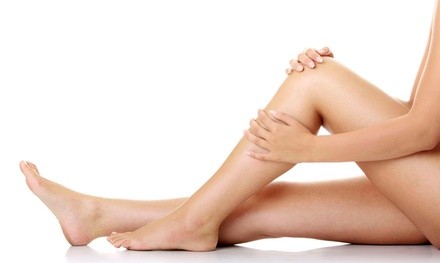$129 for Two Sclerotherapy Spider-Vein Treatments at Boca Vein Treatment Center ($400 Value)