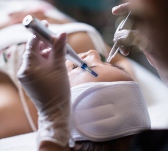 Up to 68% Off on Micro-Needling at Lynn Studio