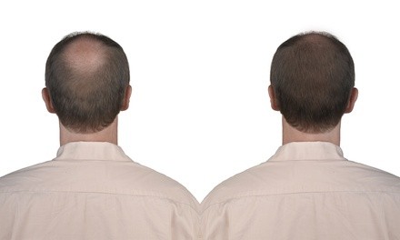 Three-, Six-, or 12-Month Finasteride Supply with Optional Minoxidil from Thrones Lifestyle (Up to 74% Off)