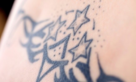 Three Tattoo Removal Sessions for Up to Three, Six, or 10 Square Inches at Luminesse Laser (Up to 75% Off)