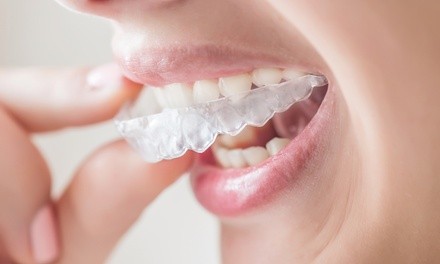 $49 for $1,500 Towards Invisalign Treatment at Walnut Creek Dental