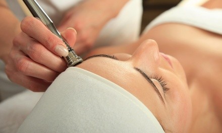 Up to 68% Off on Microdermabrasion at Forever Confidence