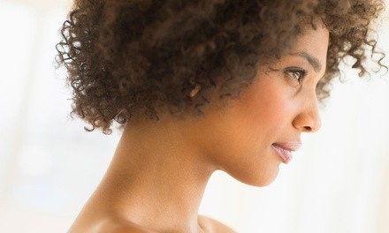 One, Two, or Four Viora Necklifts at Dolce Skin & Laser (Up to 78% Off)