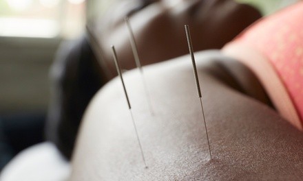 One Acupuncture Treatments at Beachside Community Acupuncture (Up to 30% Off)