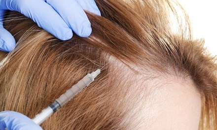 $550 for One PRP Hair-Restoration Treatment for One Area at Nirvana Medical Aesthetics ($999 Value)