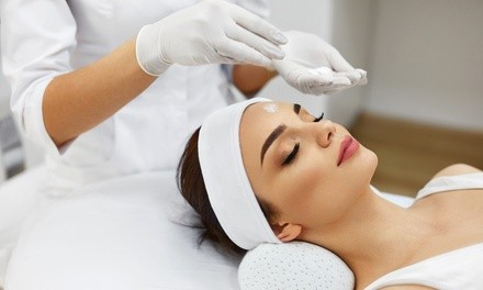 Chemical Peels and Microdermabrasion at Evolution Body Transformation (Up to 65% Off). Four Options Available.