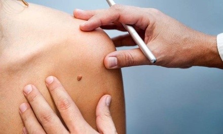 Up to 75% Off on Mole / Growth Removal at Fibroblast Aesthetics