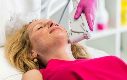Up to 70% Off on Ultherapy / Ultrasonic Facial at Shape Of You