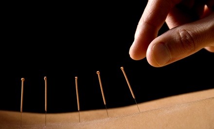 Up to 50% Off on Acupuncture at Calling Acupuncture Clinic