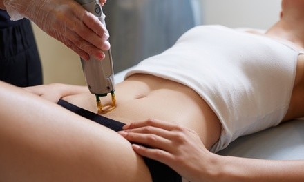 Up to 44% Off on Laser Hair Removal at Nuvo Aesthetic And Wellness