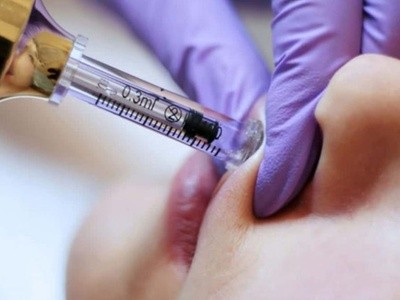 Up to 70% Off on Injection - Organic Filler at Perfected Imperfections Spa