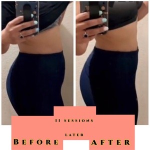 Up to 40% Off on Ultrasonic Fat Reduction at SnatchBae Esthetics