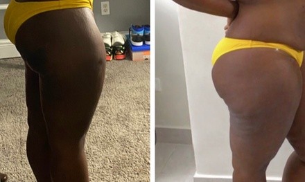 Up to 58% Off on Cavitation at SnatchBae Esthetics