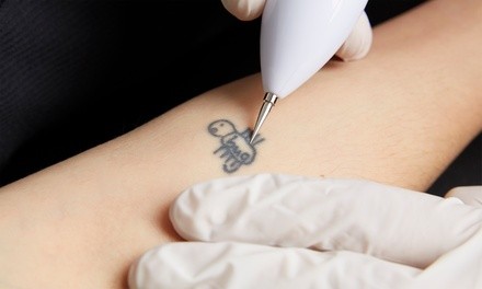Up to 64% Off on Tattoo Removal at Jinx Brows