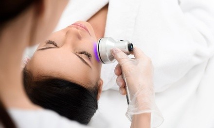 Up to 40% Off on IPL-Intense Pulse Light Therapy at Santè Spa & Wellness