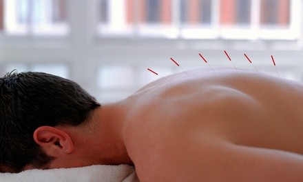 Up to 68% Off Acupuncture with Initial Assessment at Railing Chiropractic and Acupuncture