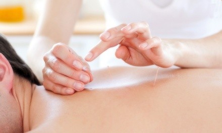 Up to 75% Off on Acupuncture Services at Whole Life Health and Wellness - Sherwood Swartz