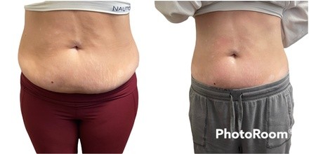 Up to 32% Off on Stomach Sculpting Session at Body Like A Goddess LLC