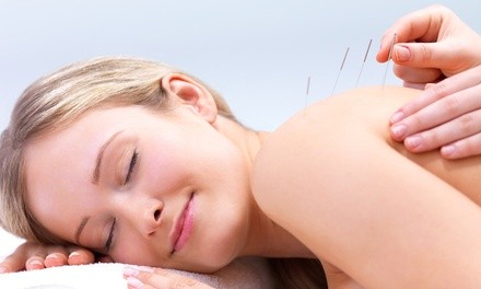 Up to 61% Off on Acupuncture at Holistic Horizons Acupuncture