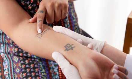 Tattoo-Removal Session on Small, Medium, or Large Area at Luxe Medica (Up to 41% Off)