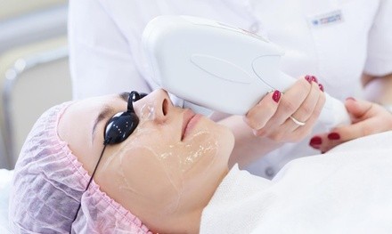 One, Two, or Three IPL Photofacials at Wild & Beautiful (Up to 73% Off)