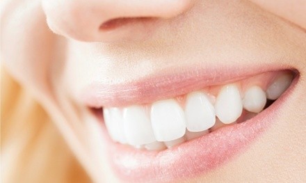 Up to 39% Off on Teeth Whitening at afterglo