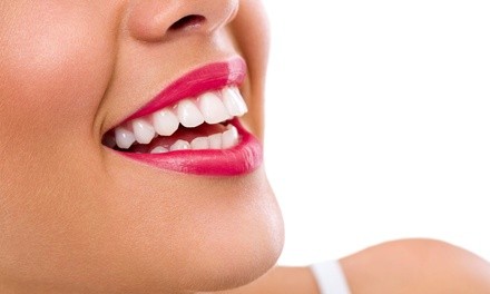 1-Hour In-Office Teeth-Whitening Treatment for One or Two at Birdie Avenue (Up to 50% Off)