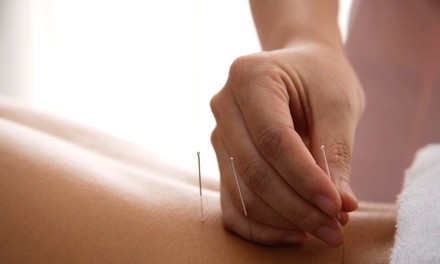 Up to 40% Off on Acupuncture at Conscious Wellness