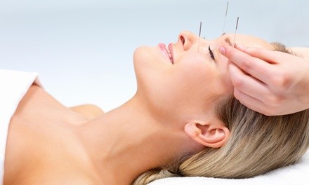 An Acupuncture Treatment and an Initial Consultation at Abundant Blessing Acupuncture (65% Off)