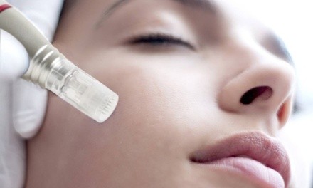 Up to 16% Off on Laser Skin Resurfacing at Healing Olympus