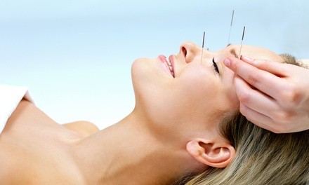 Acupuncture Treatments at Healing Tree Acupuncture & Wellness Center (Up to 50% Off). Three Options Available. 